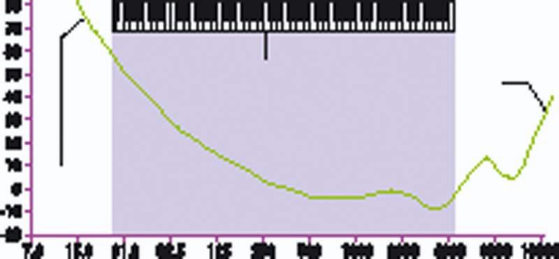 audiogram.jpg